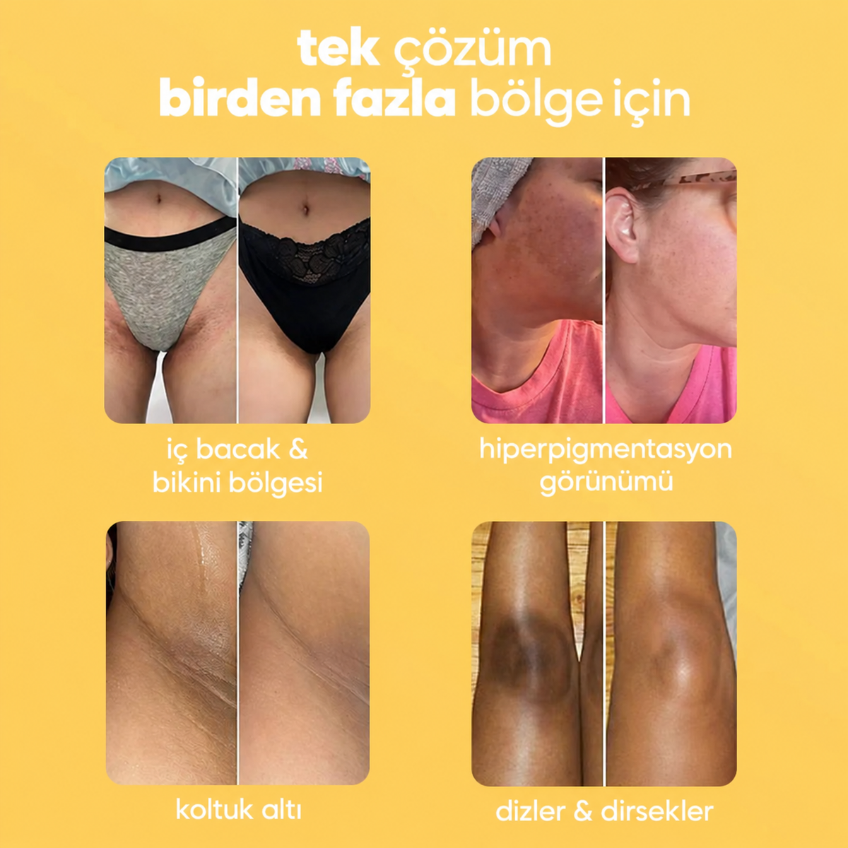 VevCare Koyu Leke ve Hiperpigmentasyon Karşıtı Aydınlatıcı Sabun