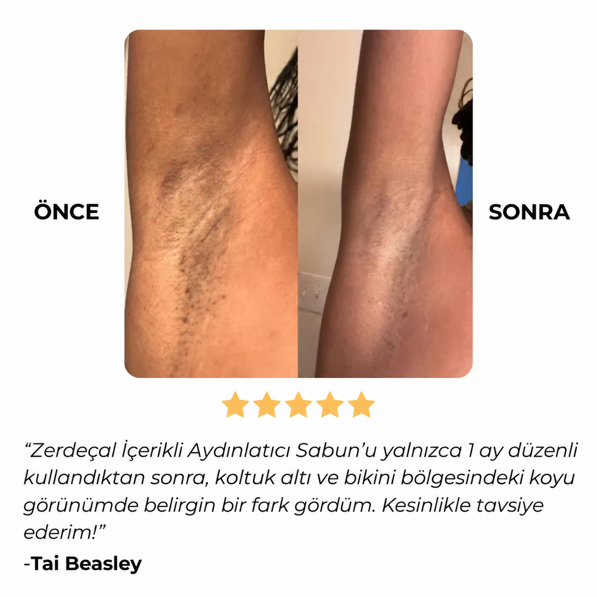 VevCare Koyu Leke ve Hiperpigmentasyon Karşıtı Aydınlatıcı Sabun