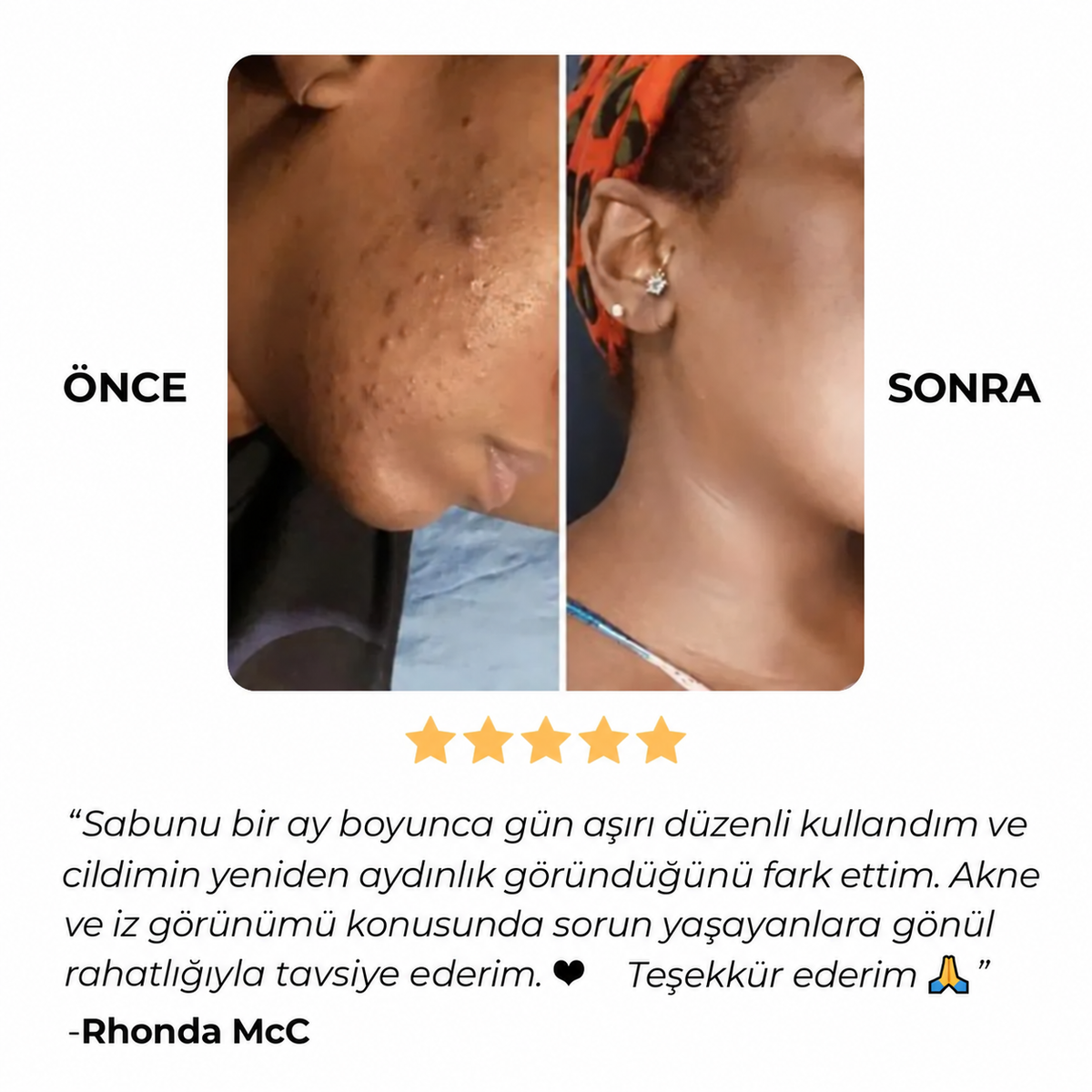 VevCare Koyu Leke ve Hiperpigmentasyon Karşıtı Aydınlatıcı Sabun
